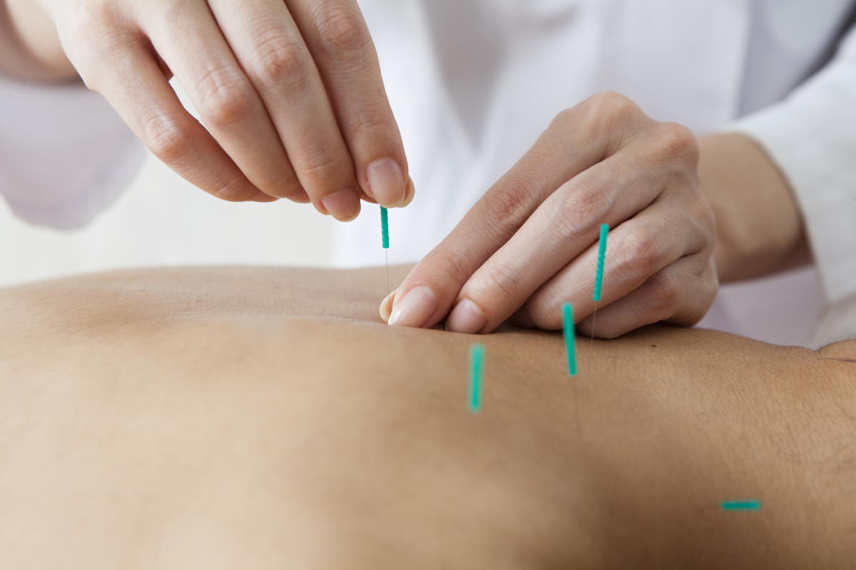 Physiotherapy Treatments