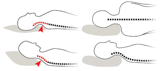 Neck Pain Pressure Points