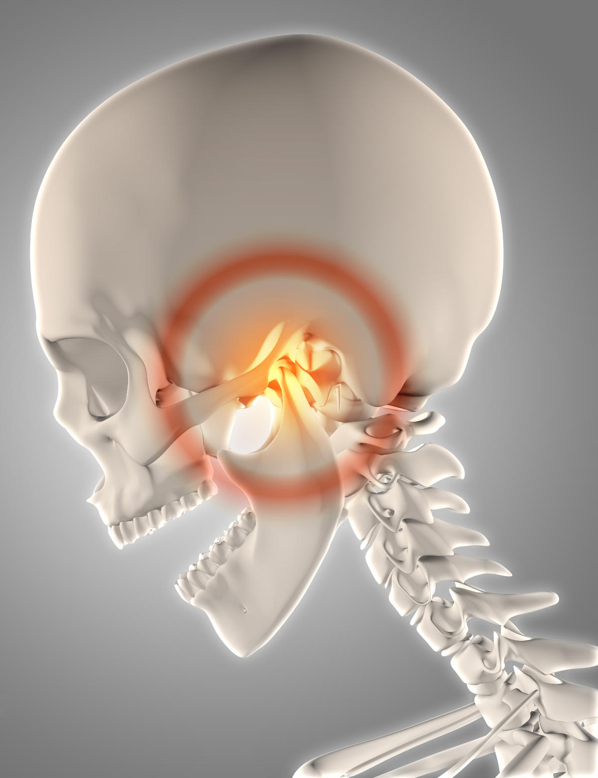 Diagram of Where TMD/TMJ Presents